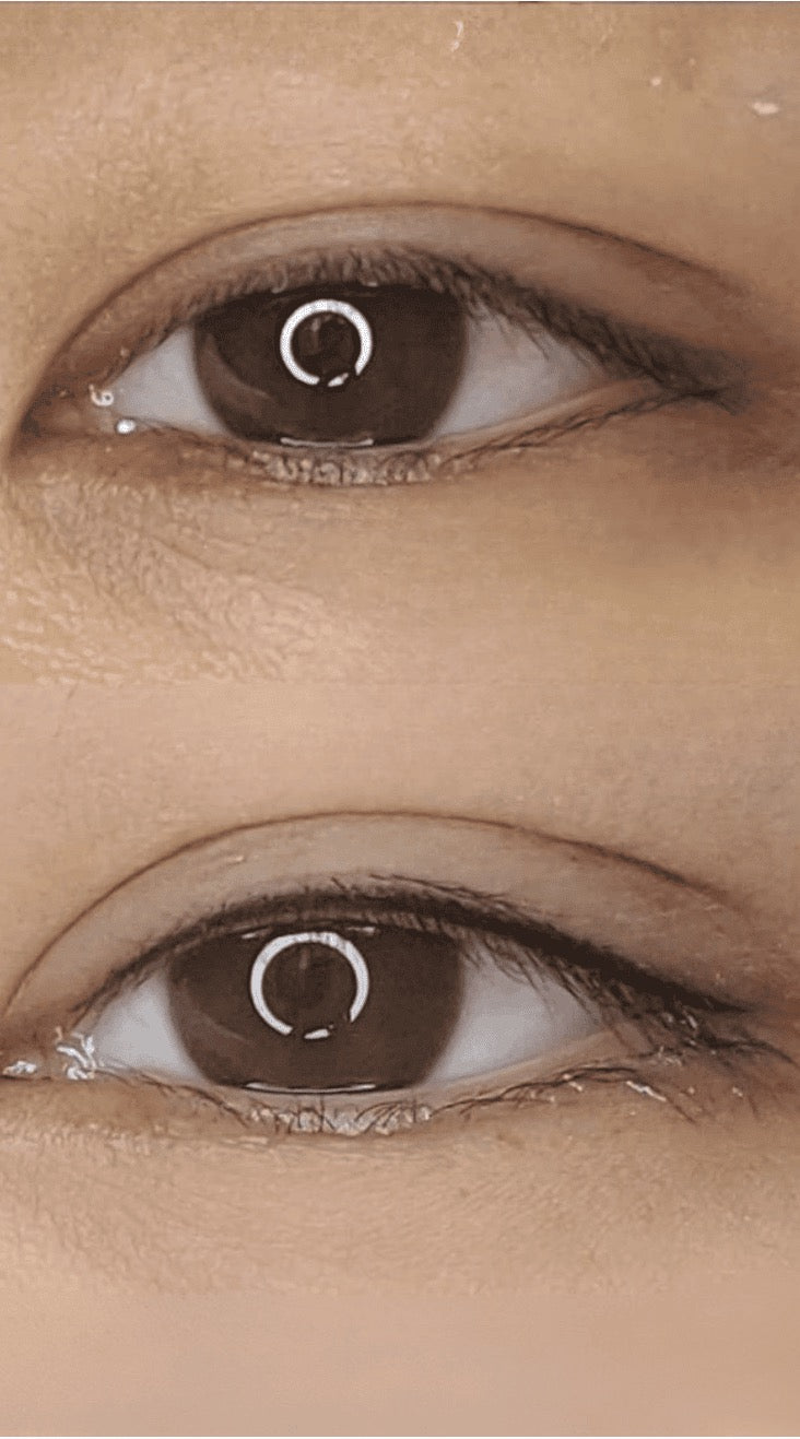 Lash Line Enhancement