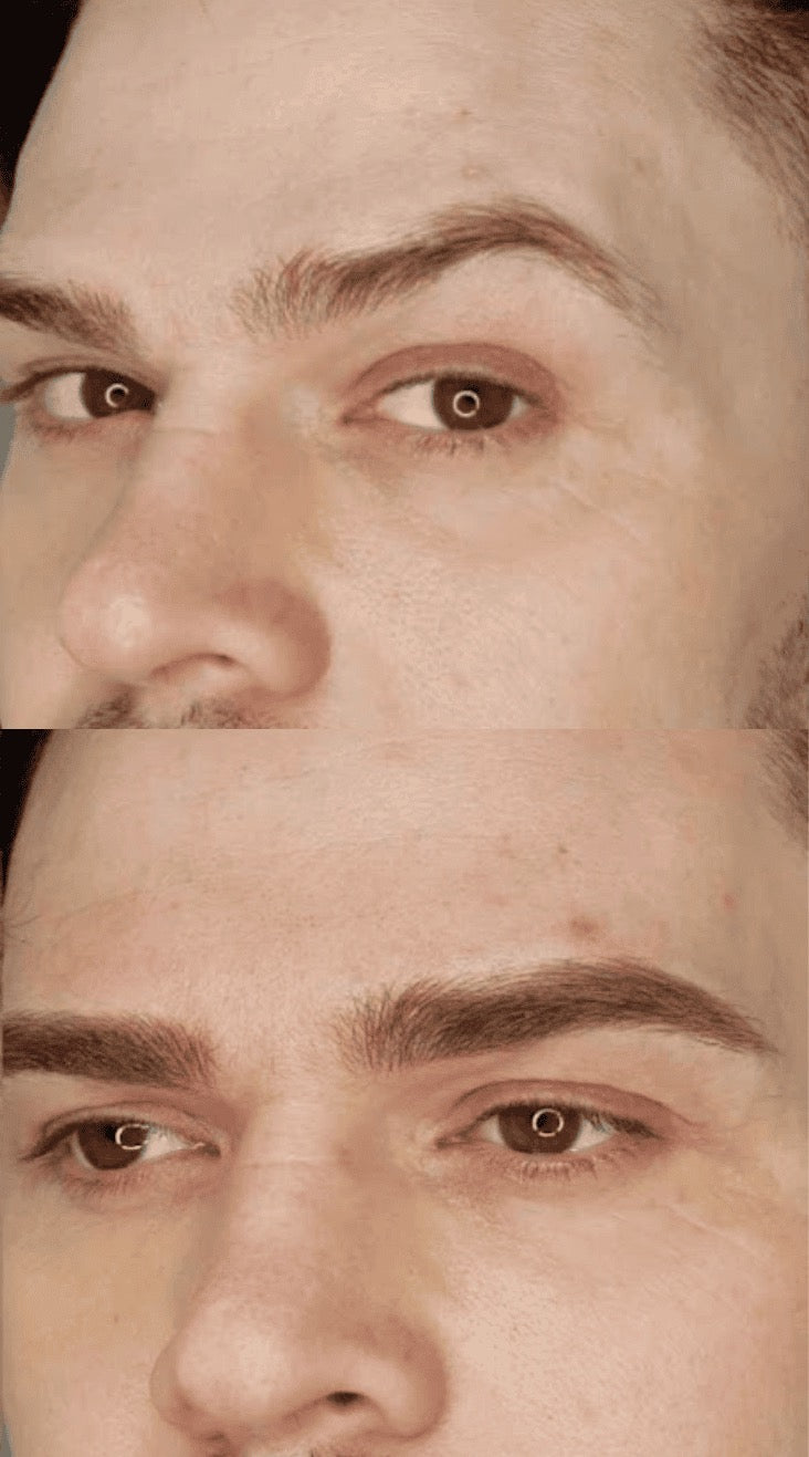 Men’s Eyebrow Microblading