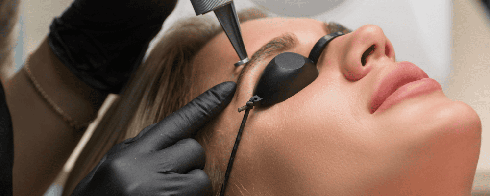 Want an old tattoo removed?
